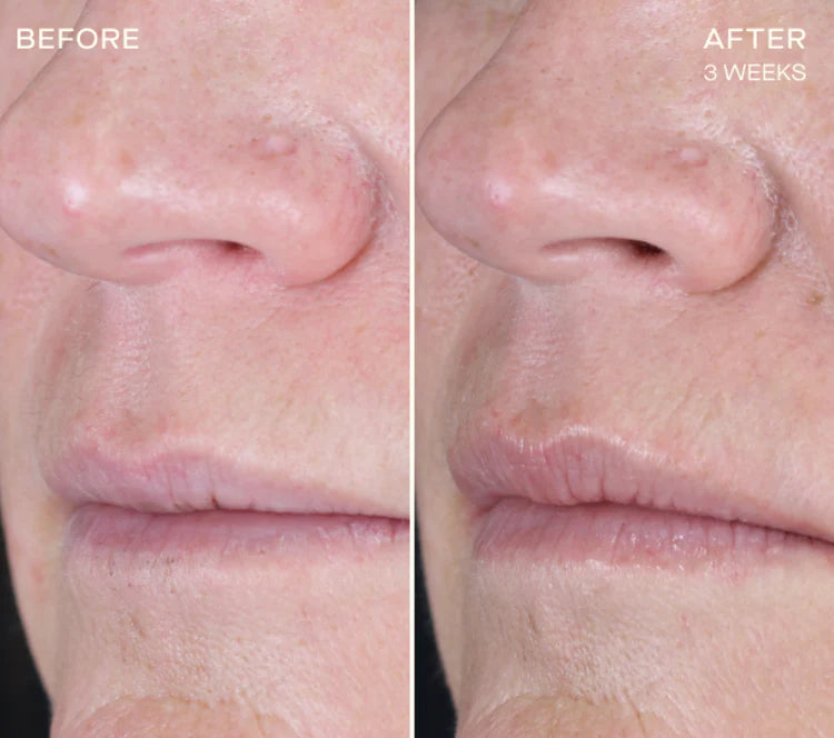 The Lip Plumping and Enhancing Regimen