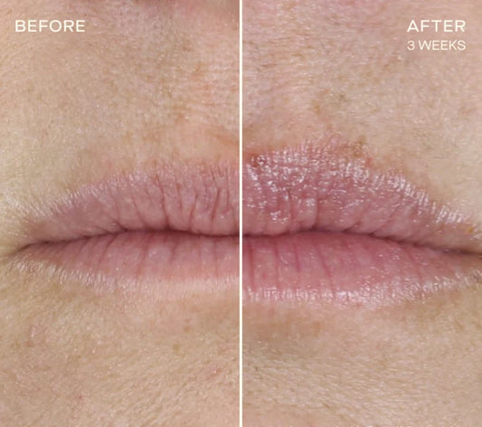 Ourself Lip Enhancing Regimen