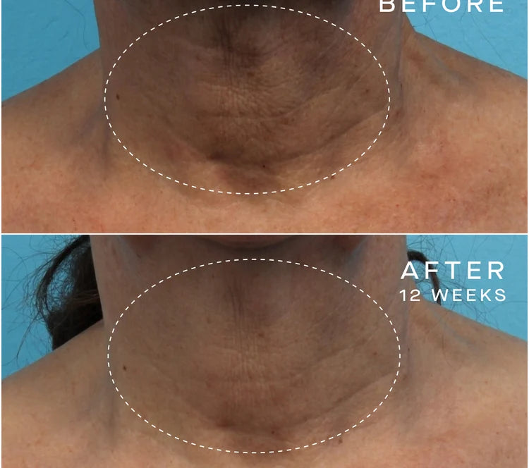 Advanced Regenerative Serum
